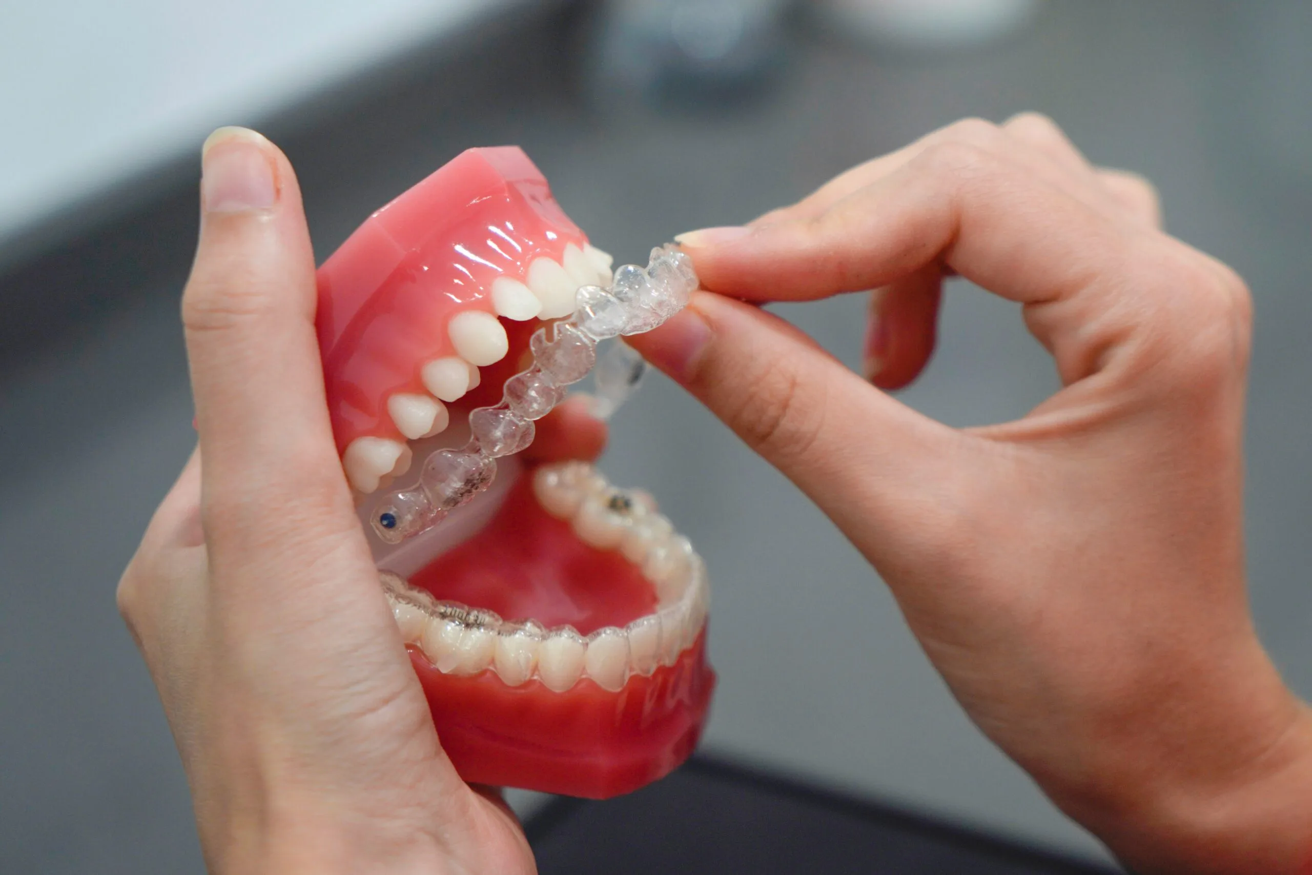 Invisalign clear aligner close-up
